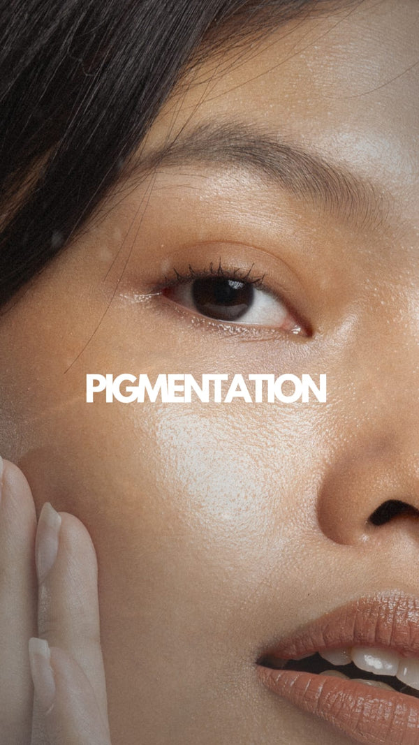 PIGMENTATION